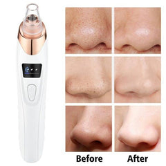 5 in 1 Rechargeable Blackhead Remover Vacuum