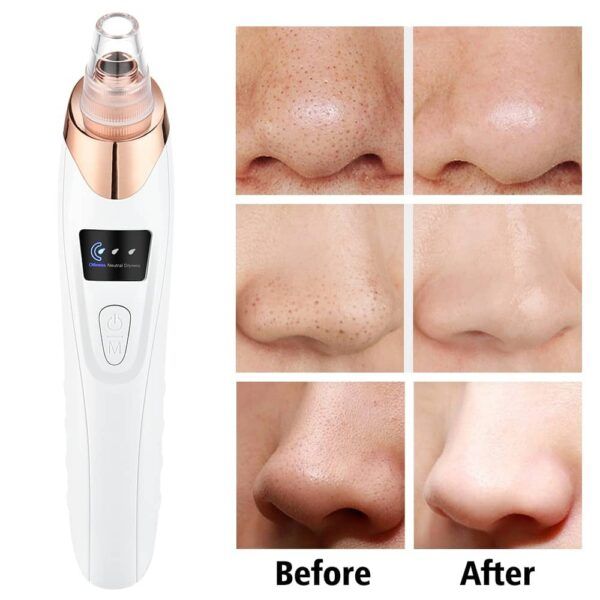 5 in 1 Rechargeable Blackhead Remover Vacuum