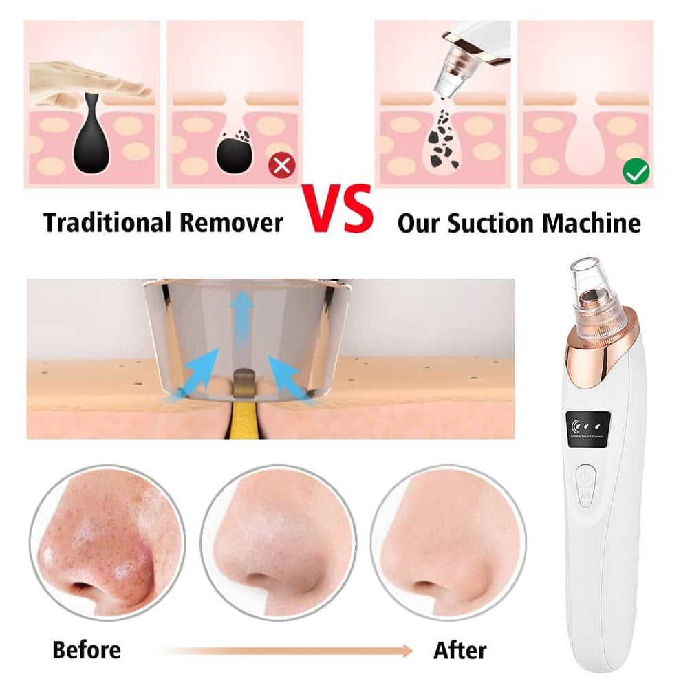 5 in 1 Rechargeable Blackhead Remover Vacuum